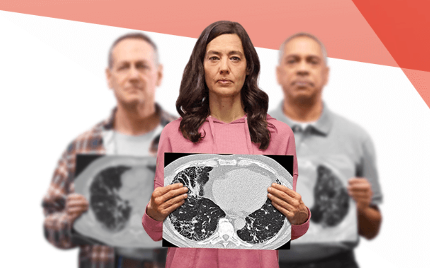 pulmonaryfibrosis360.com